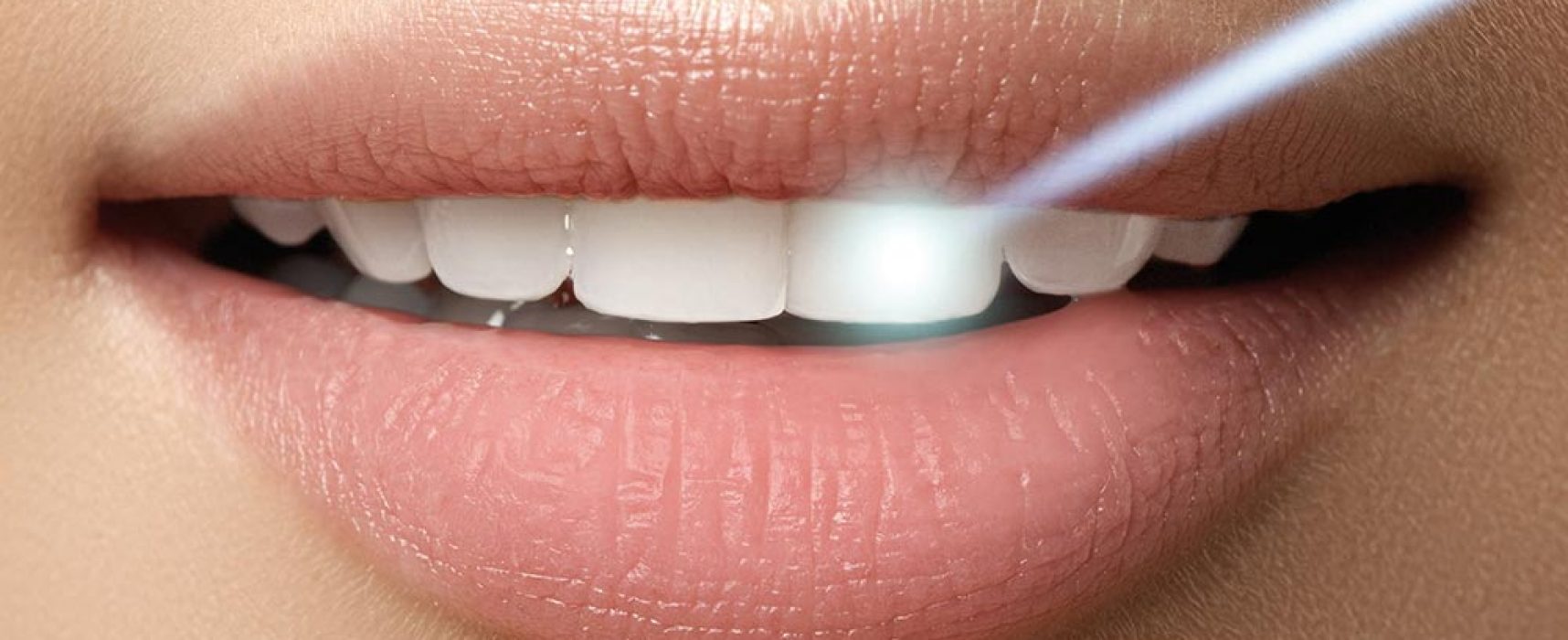 Laserterapia na Odontologia
